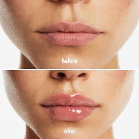  Side-by-side before and after comparison photos showing the immediate plumping and volumizing effect of Smooche Extreme Lip Plumper on lips