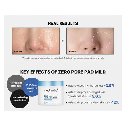 ALT results
Medicube Zero Pore Pad results for smoother, clearer-looking skin and refined-looking pores