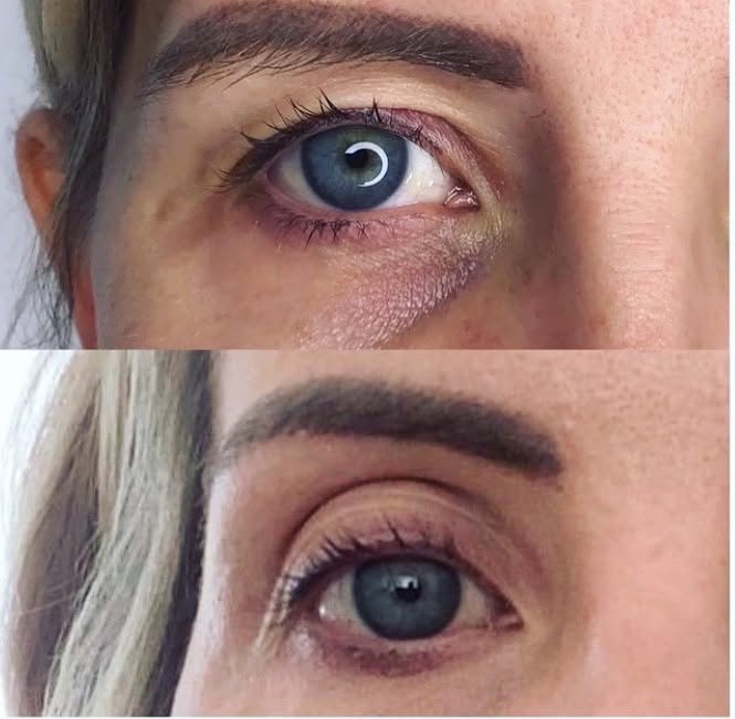 PLASMA HOODED EYE